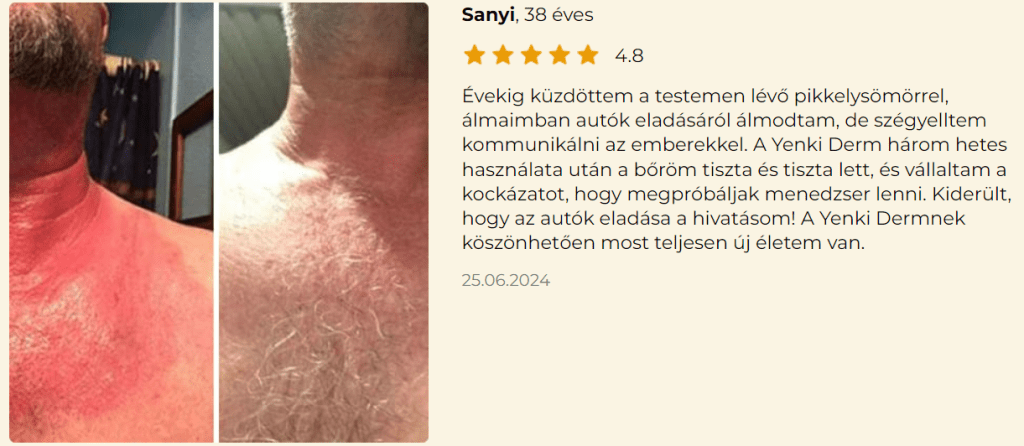 Yenki Derm