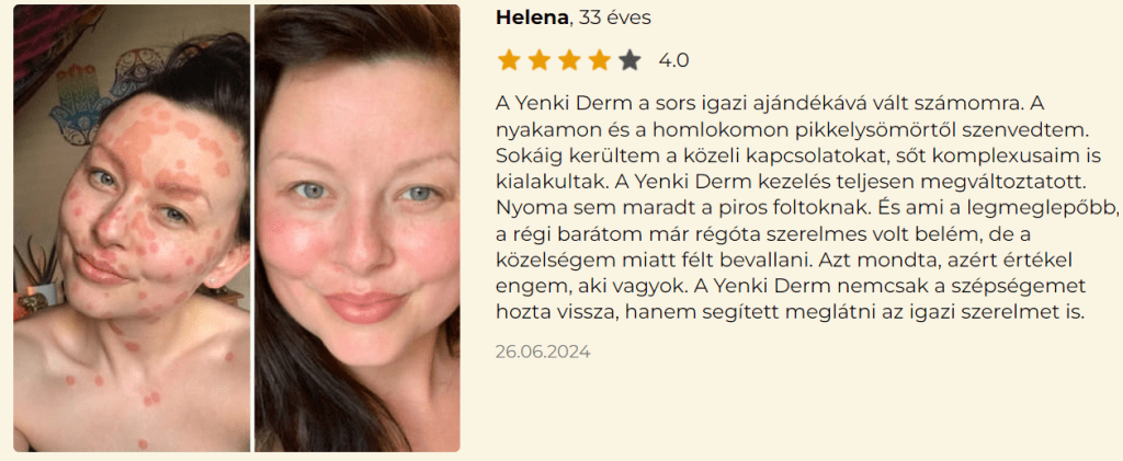 Yenki Derm