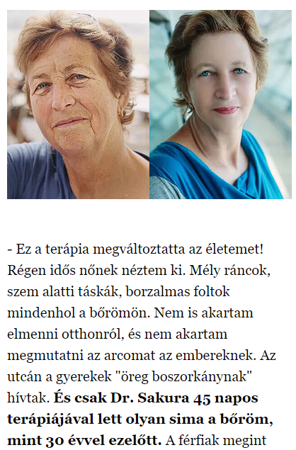 Elesse krém 