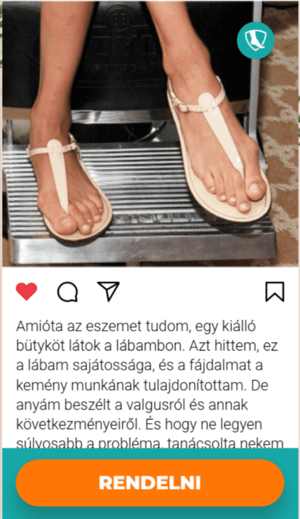 hallux valgus